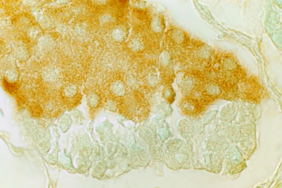 Cellules sécrétrices d'insuline - Ilôt de Langerhans du Pancréas (traitement histochimique) x100